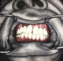 Teeth-01